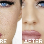 fondötenin yüzde pütür pütür durması