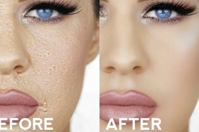 fondötenin yüzde pütür pütür durması