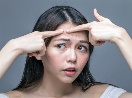 Başarılı Sonuç Veren Sivilce Tedavisi