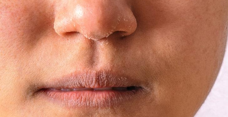 Evde Nemlendirici Maske Yapımı, Kuru Ciltlere Elveda