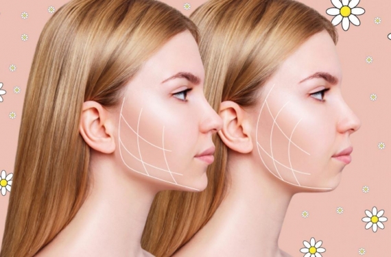 Jawline nedir ve Jawline nasıl yapılır? Jawline dolgusu geçici midir?